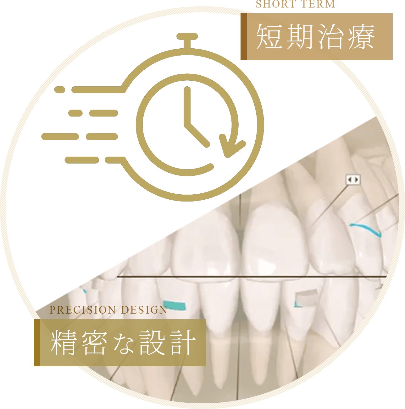 短期治療／精密な設計